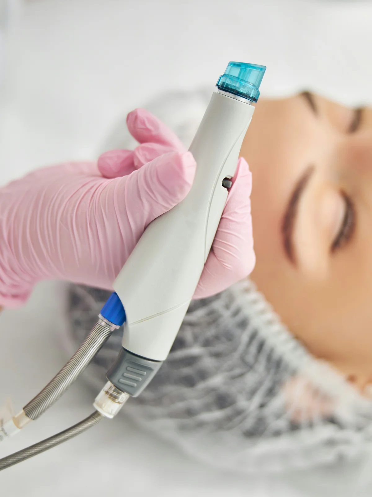 HydraFacial prietaiso su spiraline galvute stambus planas specialistės rankose